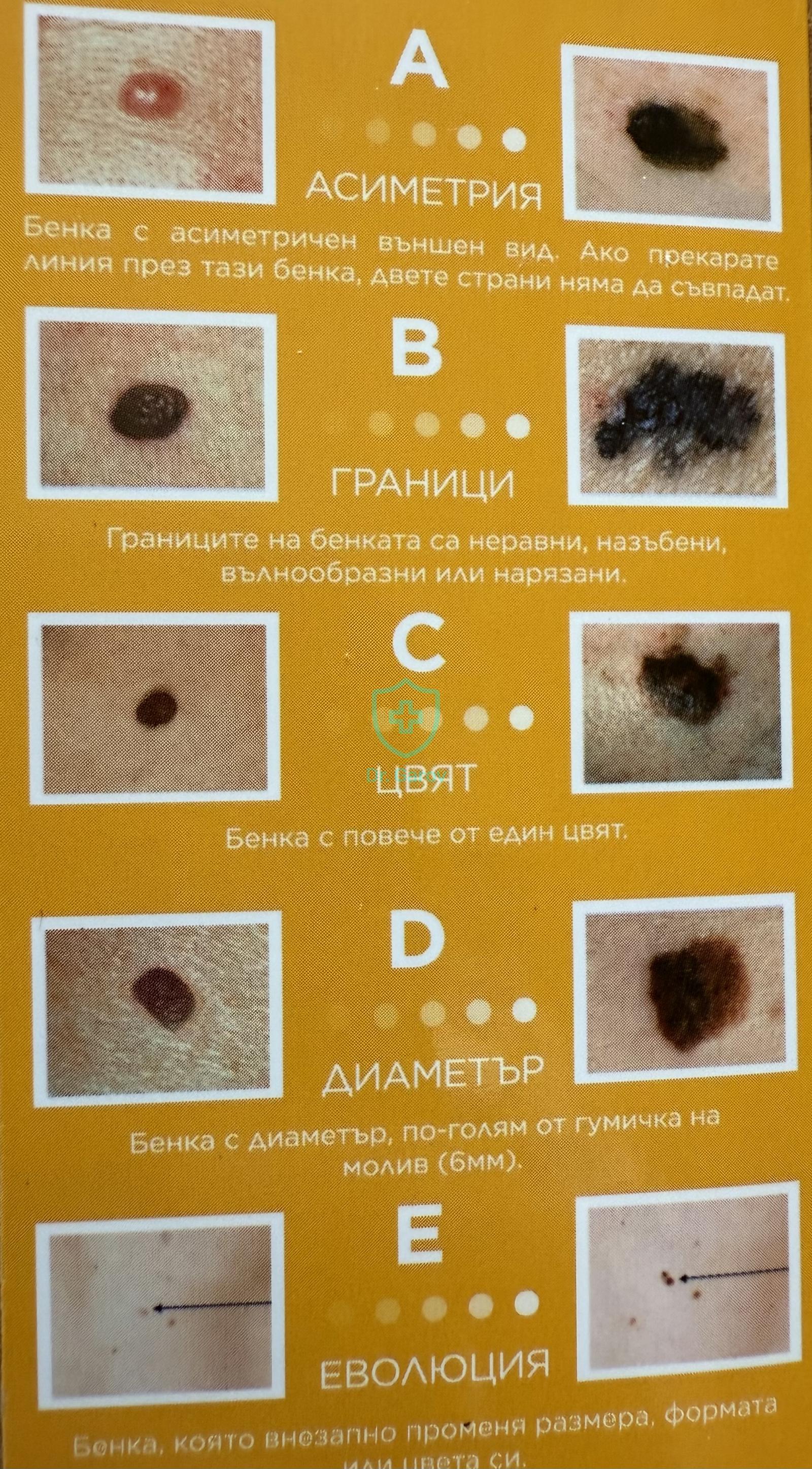 Бенки