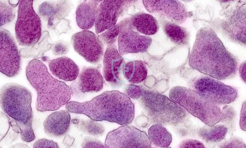 Снимка към статия Урогенитални микоплазмени инфекции